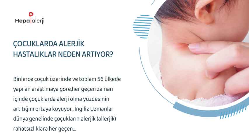 Çocuklarda Alerjik hastalıklar neden artıyor?