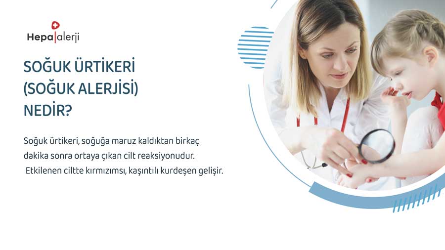 Soğuk Ürtikeri (Soğuk Alerjisi) Nedir?